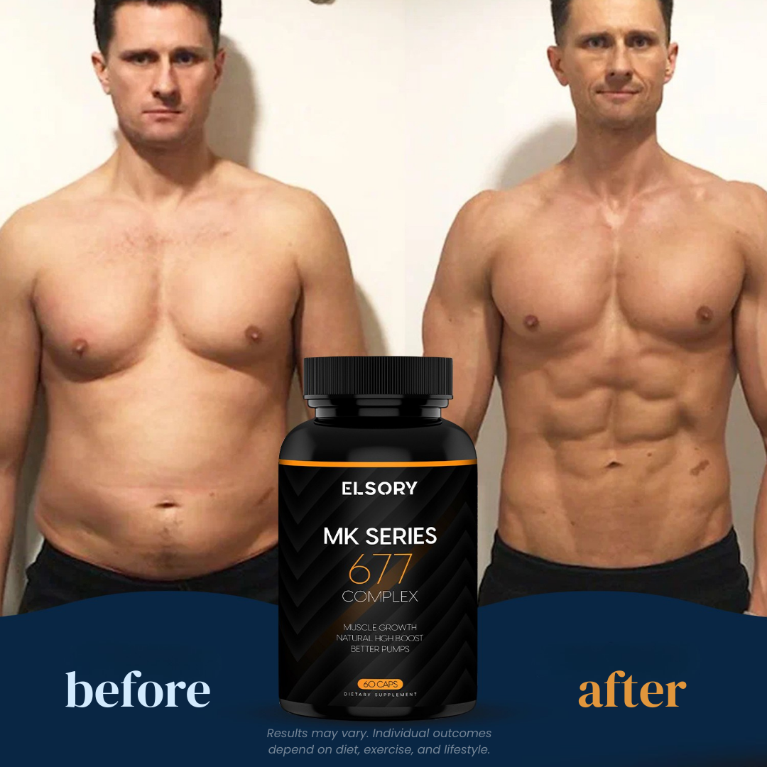 MK Series - 677 Complex