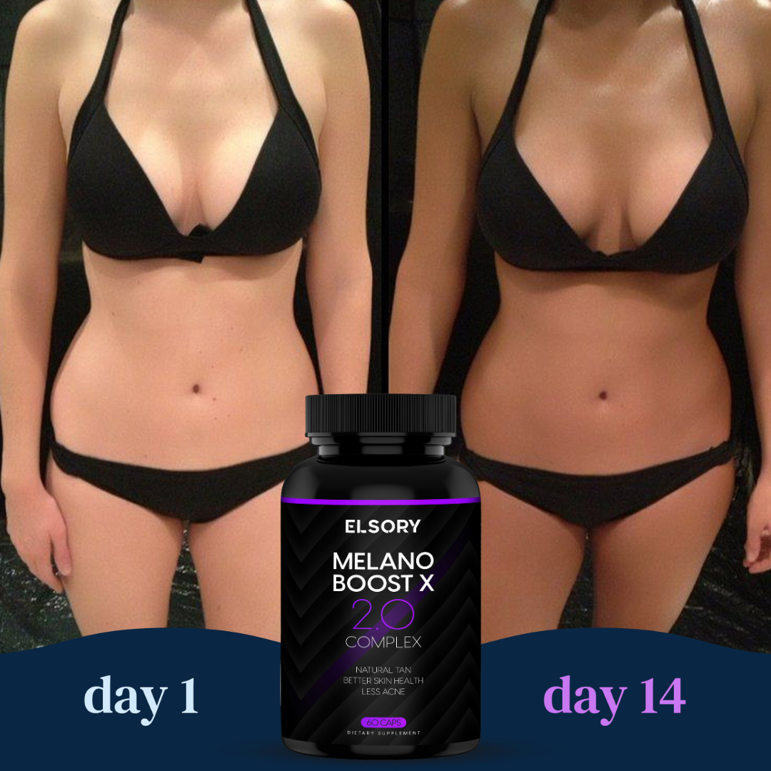 MelanoBoost X – tanning support